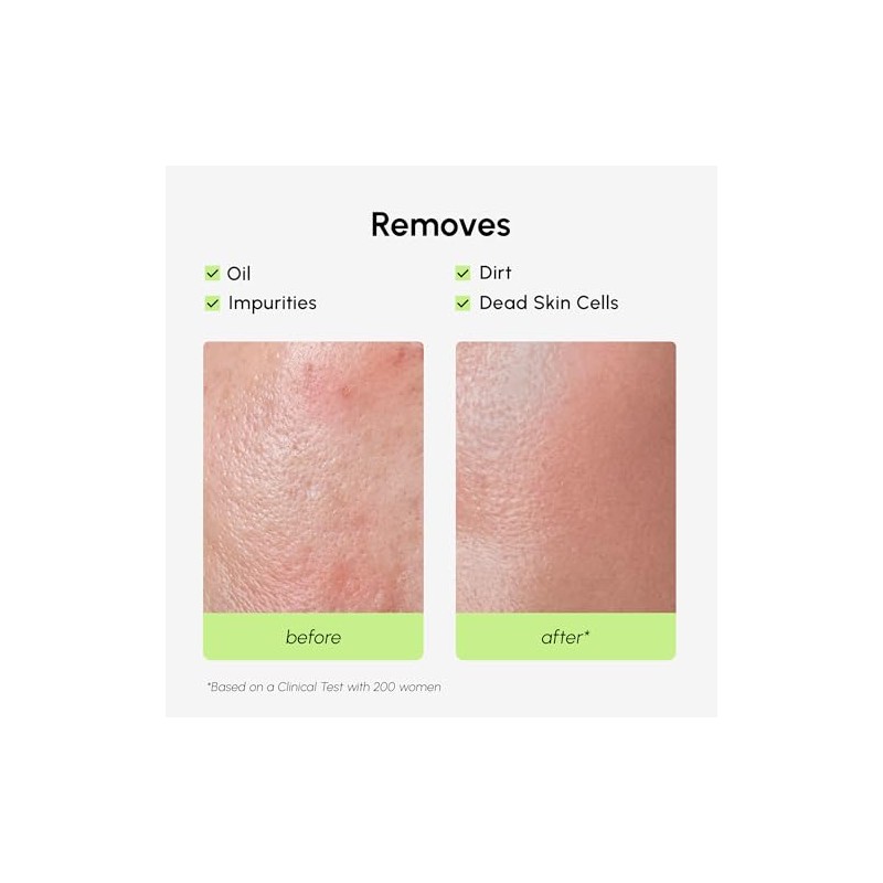 MAREE Exfoliating Toner with 2% Salicylic Acid (AHA BHA) -