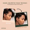 NOOR HAIR Growth Serum From African Olives, for Women and