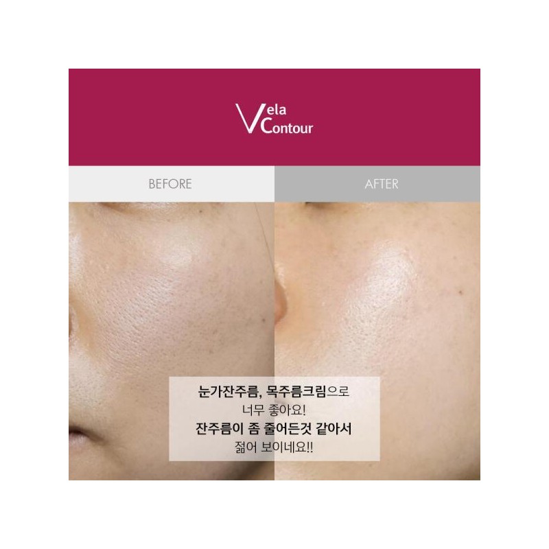 Art Box Anasis Bella Contour Apply Collagen Neck Wrinkle Neck