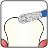 237.21F1, Pear, 2.1 mm Dia, Fine Grit Diamond Bur, 5
