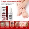 15ml Líquido Para Hongos En Las Uñas-mata Los Hongos En