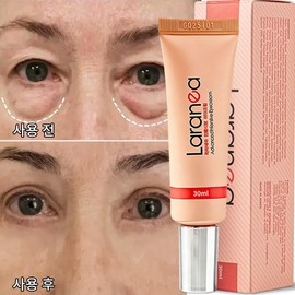 눈 밑 지방 제거 크림 여성 아이크림1위 눈 밑 지방 제거 크림1위, 30g, 1개 Top Eye Cream for Removing Under-Eye Fat - 30g, 1 piece