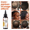 Brzeaf- 【Promueve el crecimiento del cabello】El aceite para cabello Chebe