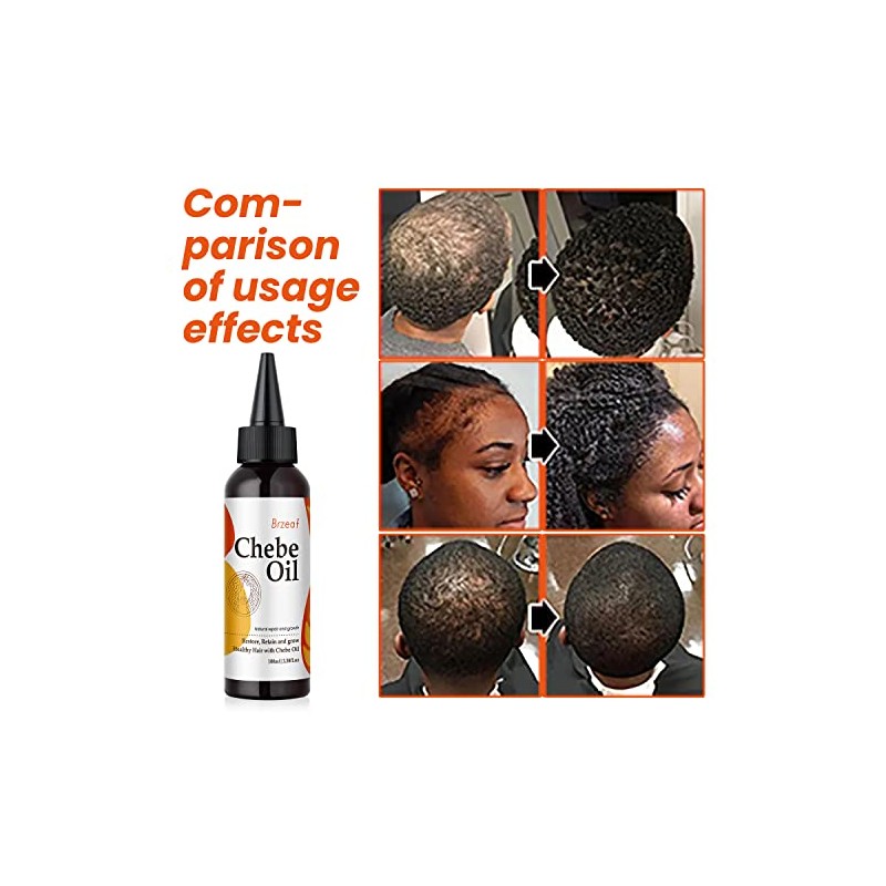 Brzeaf- 【Promueve el crecimiento del cabello】El aceite para cabello Chebe