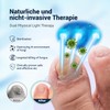 IUHFSIFS 426BWUZHID Nail Fungus Laser Device VUIYH