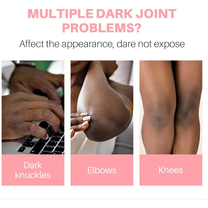 Dark Knuckle Whitening Serum, Whitening Serum Hand Knuckle Glow Serum