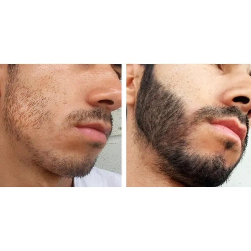 Crecer Barba Bigote Cejas Profesional Y Natural Total
