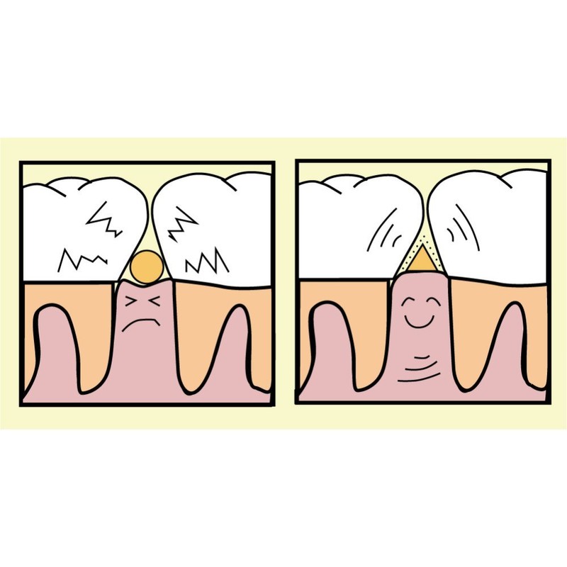 80 Clear Dent Interdental Toothpicks