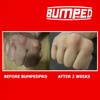 Bumped Pro Max Knuckle Protection Guards, Gel Pad Protector for
