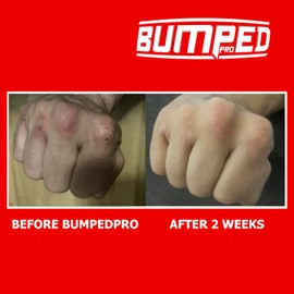 Bumped Pro Max Knuckle Protection Guards, Gel Pad Protector for Boxing and Contact Sports (Neoprene, XL)