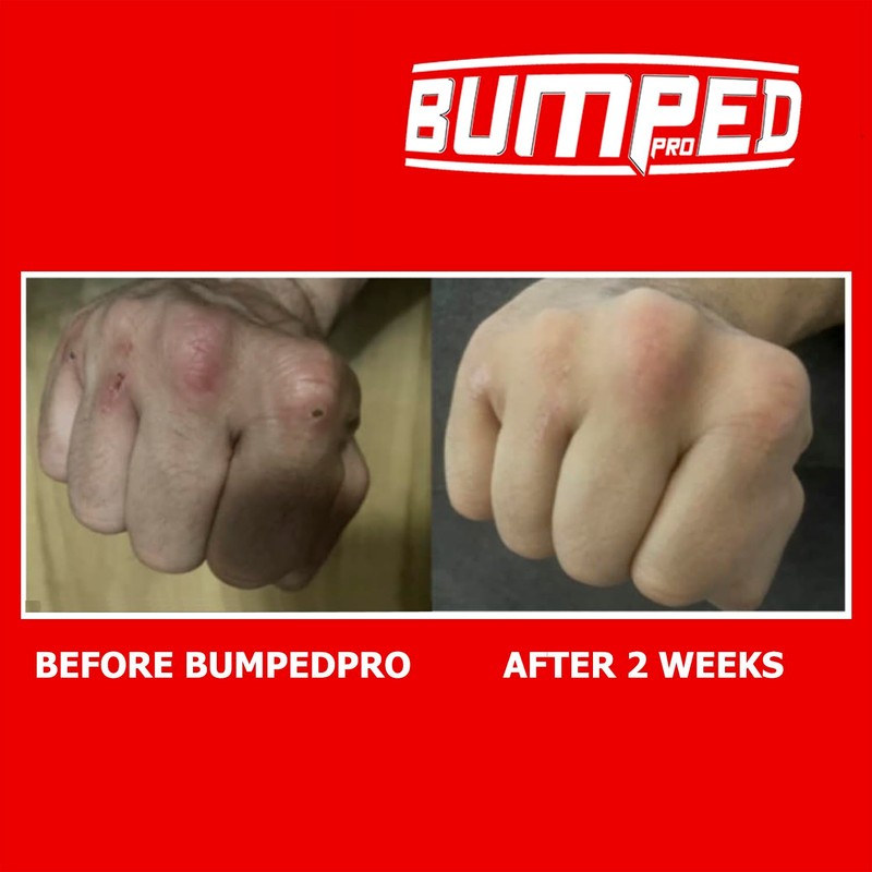 Bumped Pro Max Knuckle Protection Guards, Gel Pad Protector for