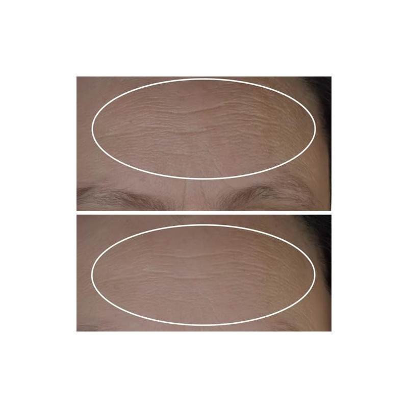 StriVectin Anti Wrinkle Peptide Plump Line Filling Bounce Serum Facial