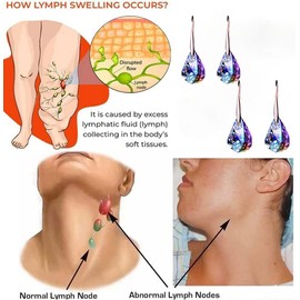 Quartz Stone Lymphatic Earrings, 2Pcs Lymphvity Germanium Earrings, Lymphatic Drainage Earrings, Crystal Sparkling Dangle Acupuncture Earrings for Women Jewelry Gifts, Zinc, No Gemstone