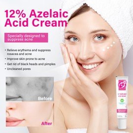 Azelaic Acid, Azelaic Acid, 12% Azelaic Acid Cream to Relieve Redness on the Face, Dark Spots, Rosacea, Acne and Regulate Excess Sebum