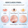 Serum Anti Acné Ácido Salicílico 2% Exfoliante Puntos Negros