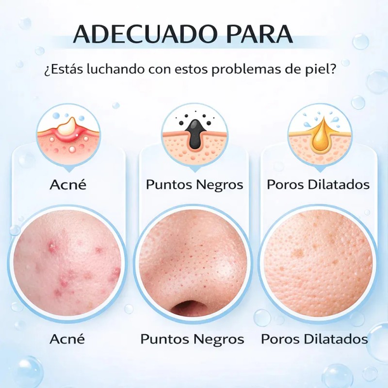 Serum Anti Acné Ácido Salicílico 2% Exfoliante Puntos Negros