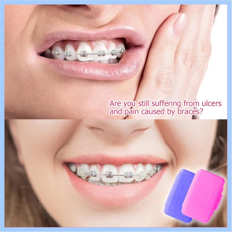 Box of 10 Braces Wax, Orthodontic Wax, for Braces Wearers