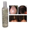 Shampoo Concentrado Para La Caida, Mxshw-001, 1 Pza, 250ml