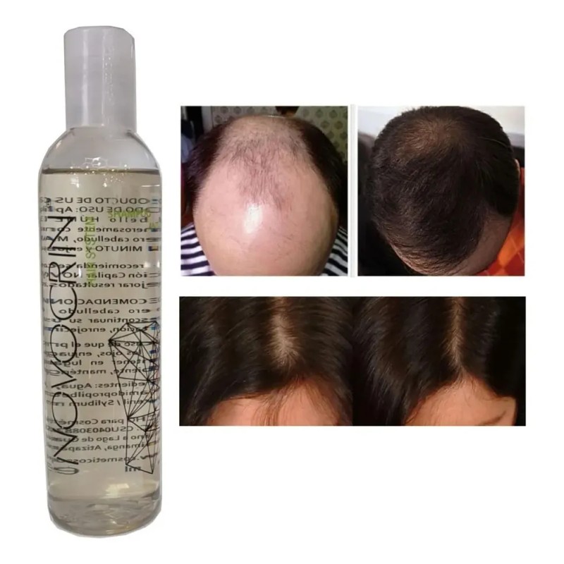 Shampoo Concentrado Para La Caida, Mxshw-001, 1 Pza, 250ml