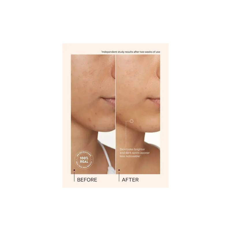 Tratamiento Para Manchas Peach & Lily Transparent C 20ml