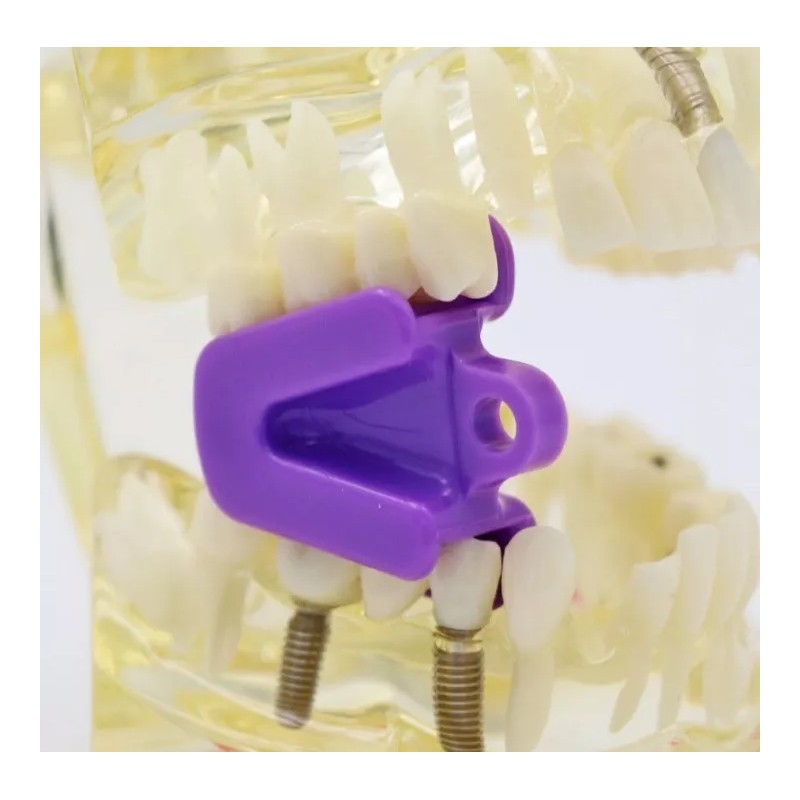 Vedent Cln Kit Abrebocas Dental Silicona Chico Mediano Grande