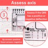 Yeanifeana ECG 7 regla de pasos, ECG 7 regla de