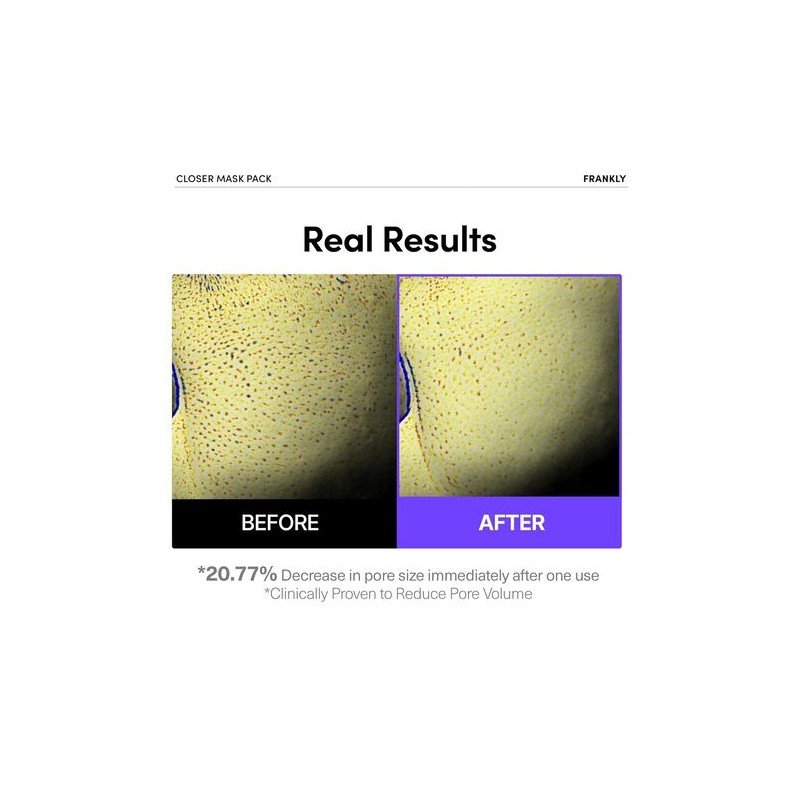FRANKLY [FRANKLY]Closer Pore Minimizing Mask (1ea)