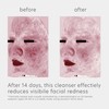 EltaMD Skin Recovery Amino Acid Foaming Facial Cleanser, Gentle Face