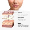 Cara Crema para Manchas Oscuras en La Cara, Cremas Quitar