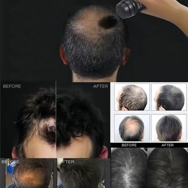 Polvo De Fibra Capilar Negro Cubre Raz De Cabello Calvicie