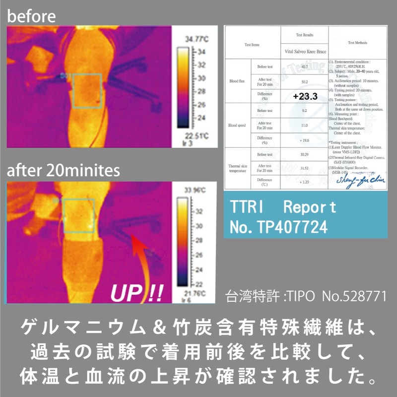 【VITAL SALVEO バイタルサルヴェオ】3D膝スリーブ S-SUPPORT 膝サポーター 膝バッド CJ-5108/5109 (L, ダークグレー, 1)