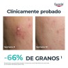 Eucerin DermoPure Triple Effect Serum 40ml Piel Grasa o Acné