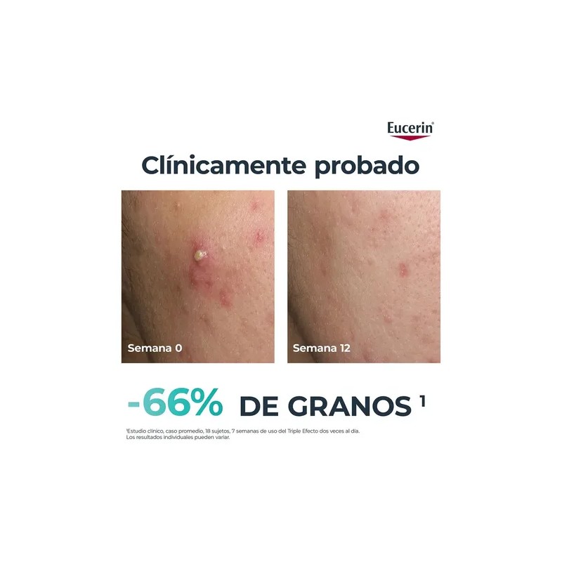 Eucerin DermoPure Triple Effect Serum 40ml Piel Grasa o Acné