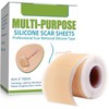 KQQKDYIR Cinta de silicona para eliminar cicatrices, parche de silicona