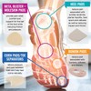 Steins Foam Corn Pads, Toe Separators, Toe Pads, Corn Cushions