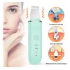 Limpiador Facial Peeling Ultrasónico Portatil Skin Scrubber