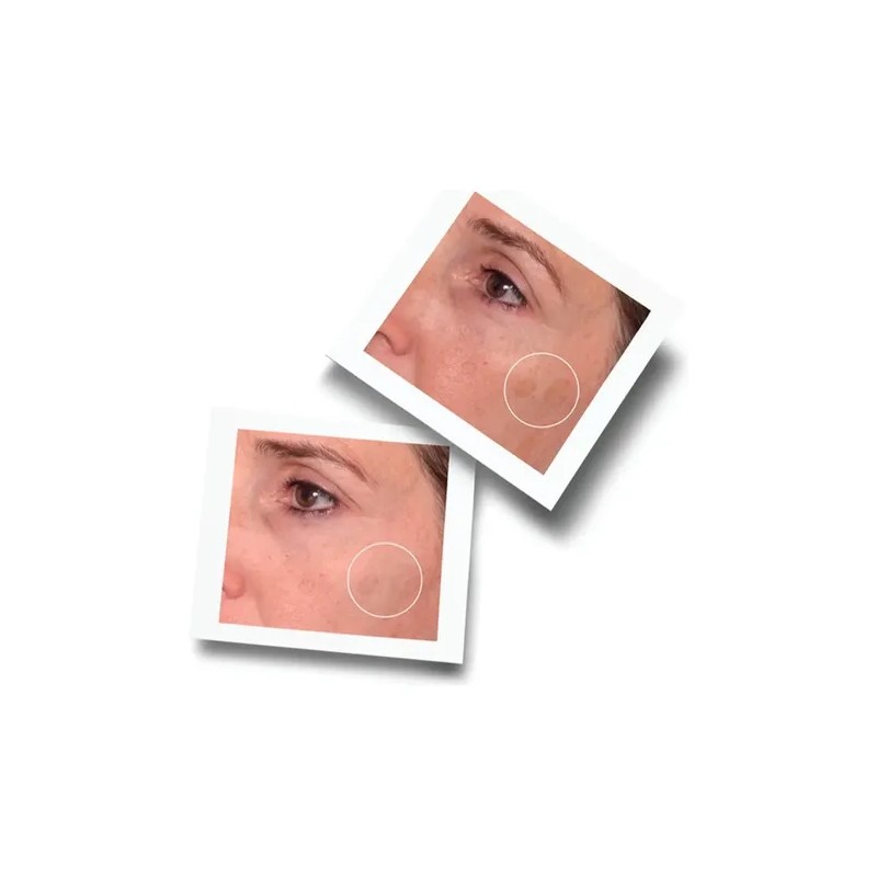Murad Suero Antimanchas con Vitamina C y Ácido Glicólico 30ml