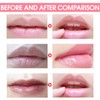 Asheyya 3 PCS Honey Lip Balm, Honeybalm Uk Lips with