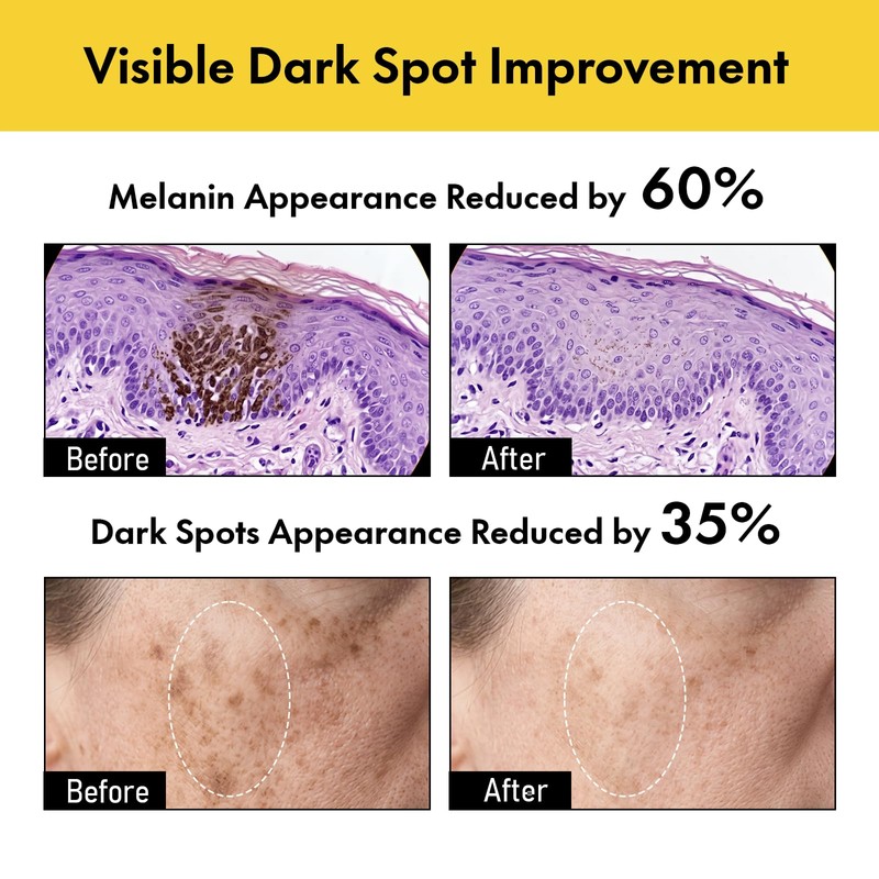 Pores Dark Spot Cream with Arbutin, Tranexamic Acid & Niacinamide