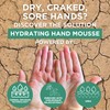footlogix Hydrating Hand Mousse with Dermal Infusion Technology® | Deep