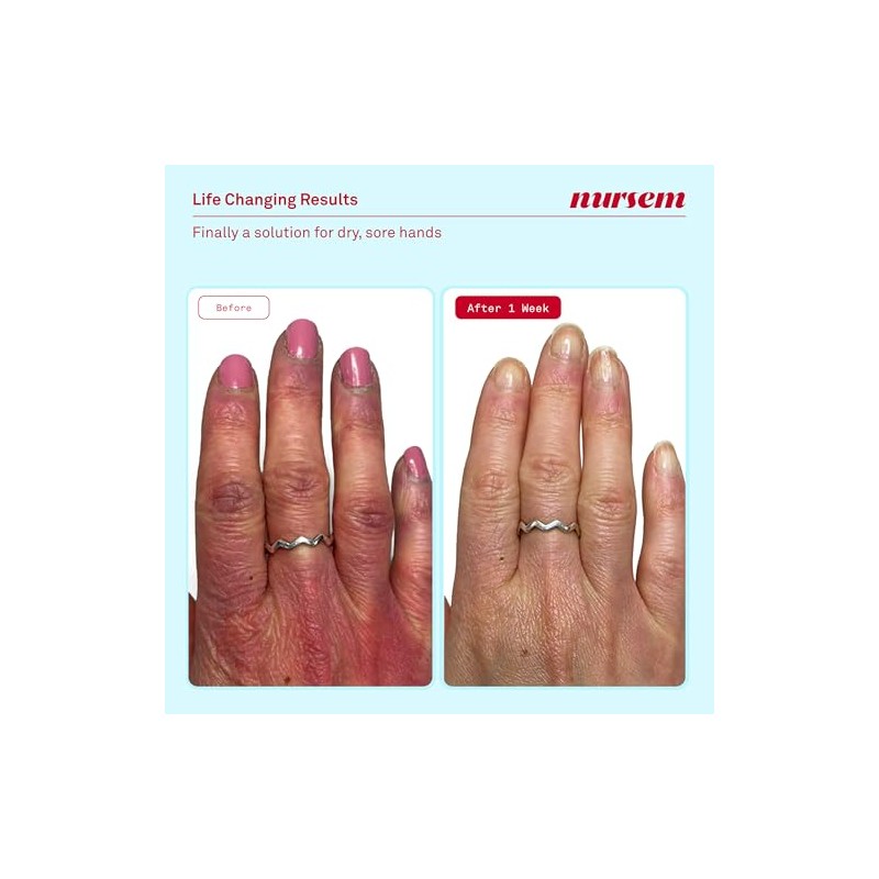 Nursem Hand Care Minis Set