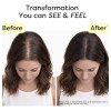 Sérum Para El Crecimiento Del Cabello Novokind Tratamiento P
