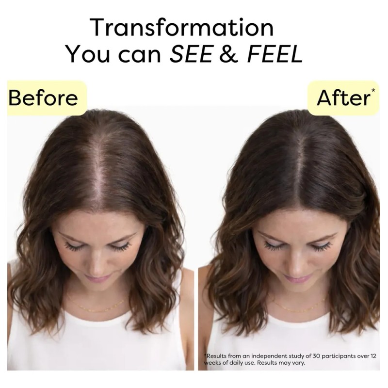 Sérum Para El Crecimiento Del Cabello Novokind Tratamiento P