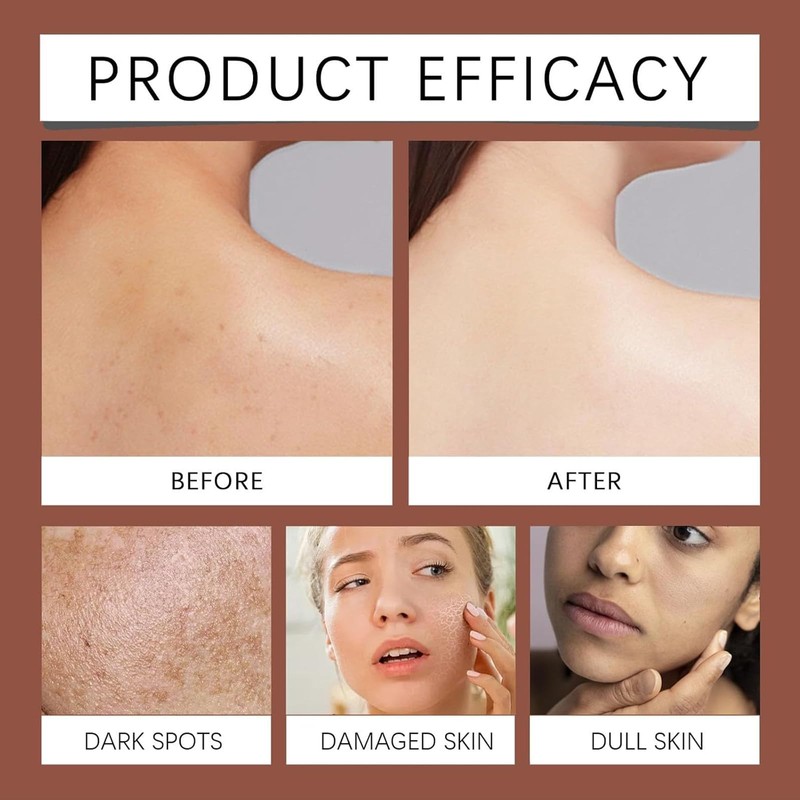 Coconut Oil for Skin - Coconut Body Oil Gel for