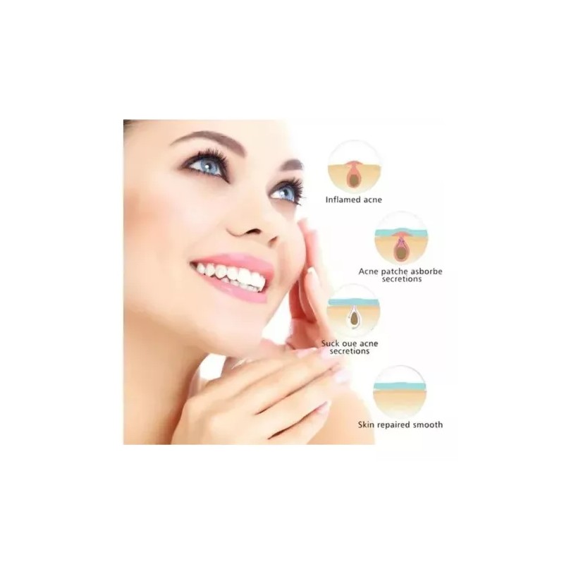 Universo en Linea 120 Parches Acné Espinillas Facial Absorbente Invisibles