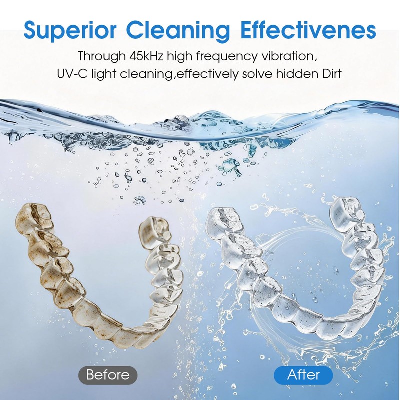 Tulbeys Ultrasonic Retainer Cleaner, 45kHz Ultrasonic Cleaner with UV Light