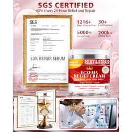 APLEFBE Eczema Cream for Kids & Adults - Eczema Relief Cream for Redness, Itchy, Dry Skin, Daily Moisturizer for Sensitive Skin, with Sea Moss, Aloe Vera, Colloidal Oatmeal, Fragrance-Free, 1.7 FL OZ