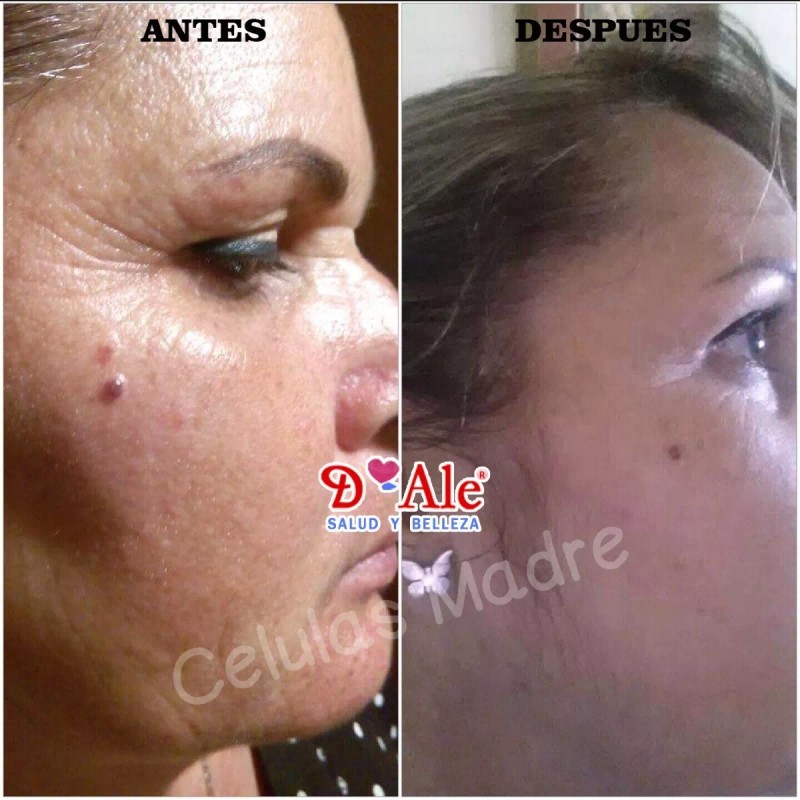 D'Ale 2 Cremas Facial Regeneradora Células Madre, Hidratante, Fps