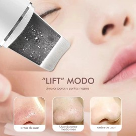 Limpiador Facial Ultrasónico Exfoliante Espinillas Belleza                                                                                            