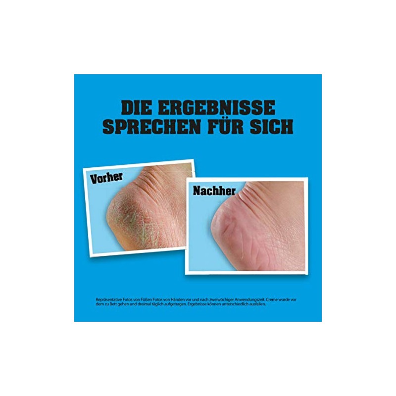 O'Keeffe's Healthy Feet Foot Cream Tube 85 ml